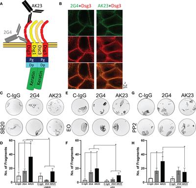 <mark class="highlighted">Dsg3</mark> epitope-specific signalling in pemphigus